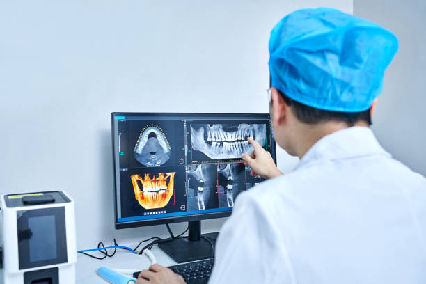 Best Knocked-Out Tooth (Avulsed Tooth) Treatment in Galveston, IN